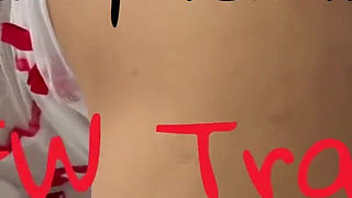 Nurse Magnita Helps a Tennis Player