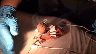 medical play fun, mummification, needle cbt and electro