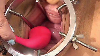 Cervix Vibration Play